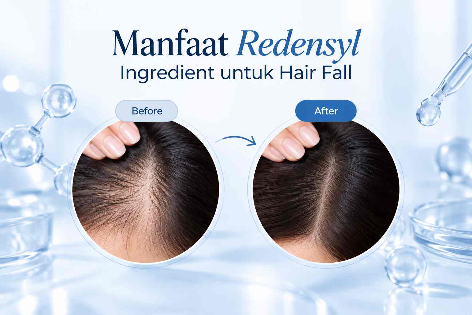 Manfaat Redensyl untuk Rambut Rontok dan Perawatan Kulit Kepala