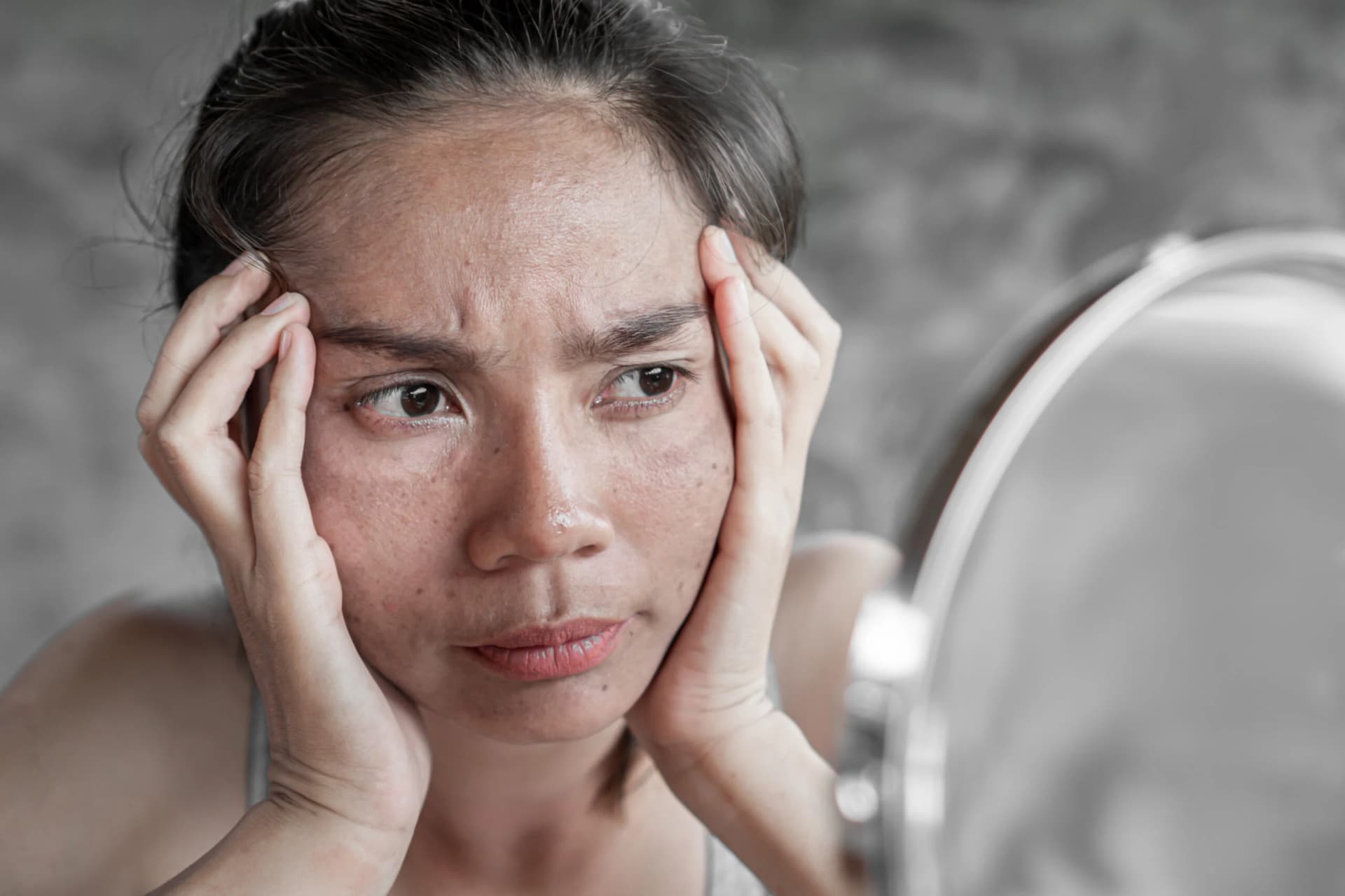 5 Cara Melembutkan Kulit Wajah yang Bersisik