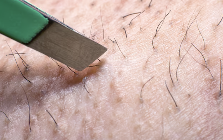 penyebab Utama & Produk Efektif Mengatasinya