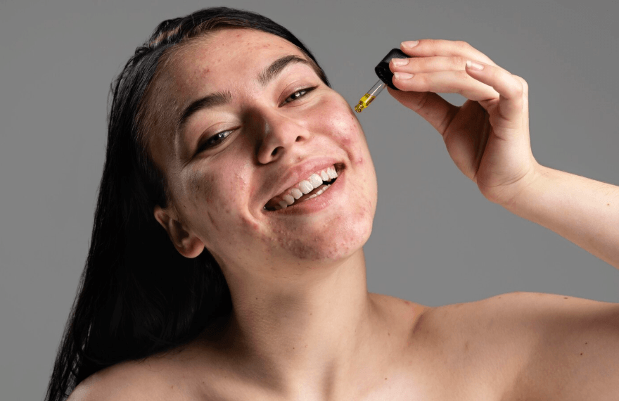 Bahan Aktif Jerawat & Cara Kerjanya